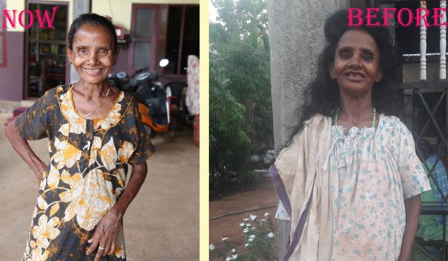 തെരുവിൽ അലഞ്ഞുനടക്കുന്ന സ്ത്രീയെ NMPC Trsut ഏറ്റടുത്തു