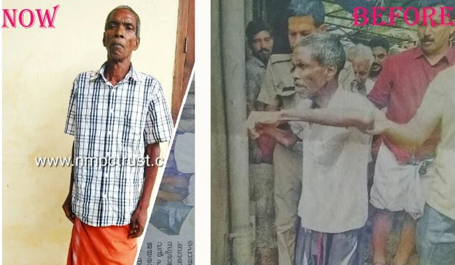 Person with critical condition at the bus stop was taken to NMPC trust